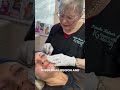 PDO Thread Lift for Nasolabial Folds | Natural Lift and Cheek Support at K2 Restorative Medicine