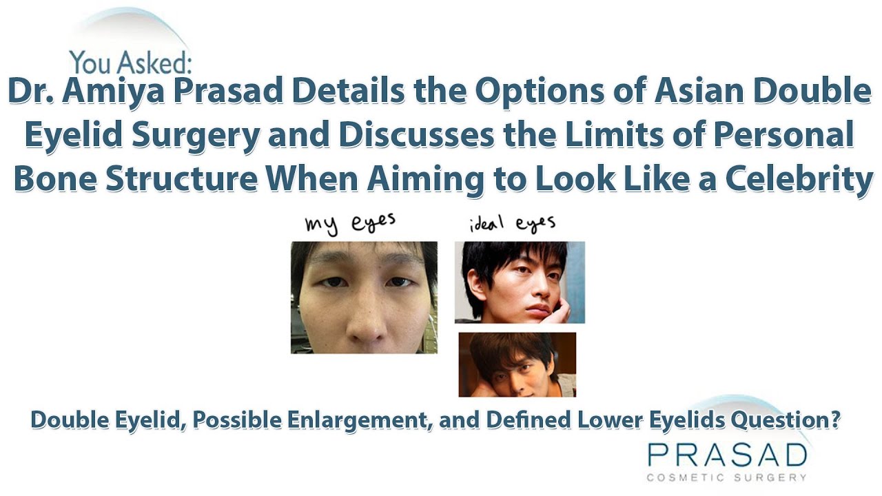 The Different Options for Asian Double Eyelid Surgery & Bone Structure Behind Facial Character