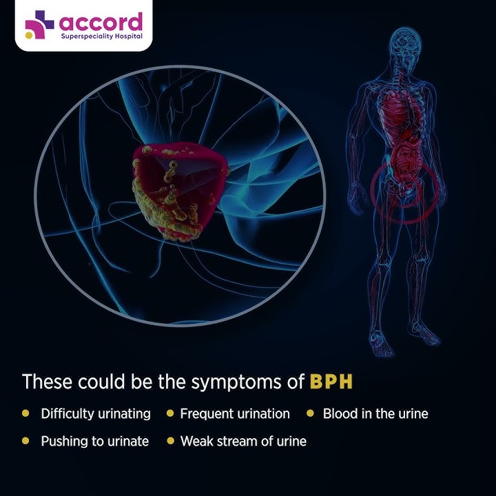 Symptoms of Benign Prostatic Hyperplasia (BPH)