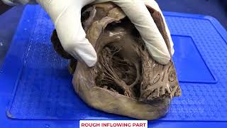 Interior del ventrículo derecho: significado clínico y embriológico