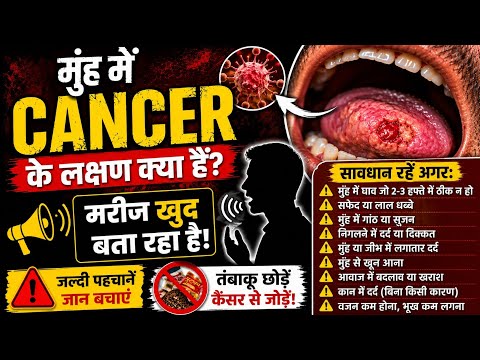 मुंह में कैंसर के लक्षण // muh me cancer ke lakshan kya hai #cancer #cancerawareness (@gunwalraj )