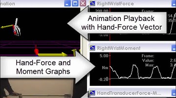 Gait Analysis with Upper Extremity Analysis
