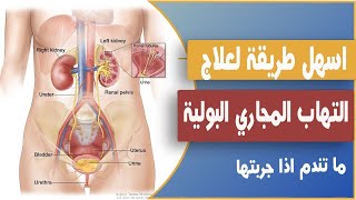 علاج ميكروب النبولة(البرد القديم) وتعفنات الجهاز البولي والضعف الجنسي/0654384052