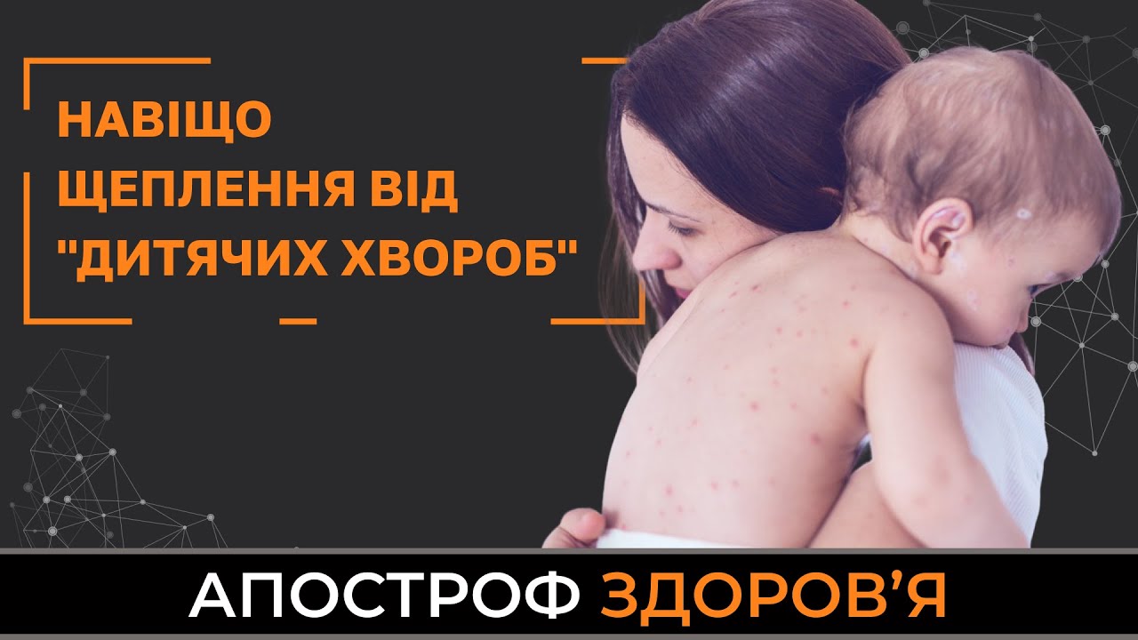 Як вберегтись від "дитячих" хвороб. Кір, краснуха, вітрянка, свинка та ...