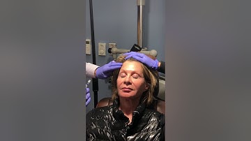 Dr Raval demonstrates a Botox injection to the forehead