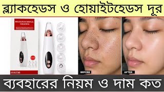 Multi functional cleaning remove blackhead device | blackheads removal machine review use and price