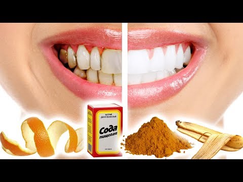 Video: Diş ağardıcılardan necə istifadə etməli?