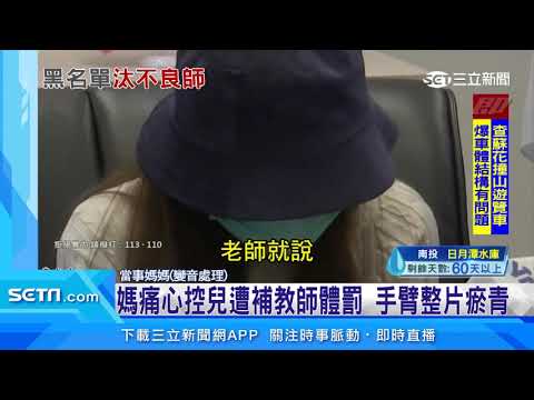 小二童手臂整片瘀青！母痛心控補教師不當體罰：牙刷都拿不起來｜三立新聞網 SETN.com