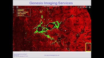 Imaging and Quantification of Fibrosis of the Kidney