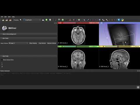 3D Slicer 4 Crop Module Demo