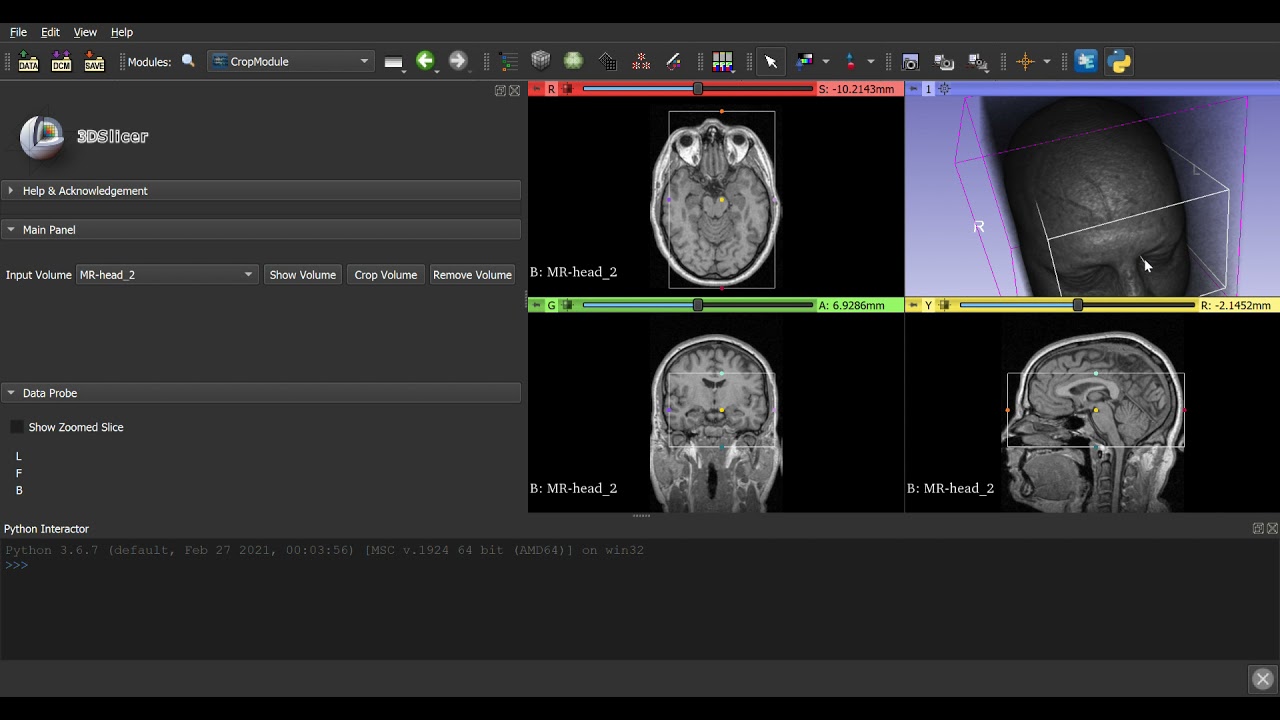 3D Slicer 4 Crop Module Demo - YouTube