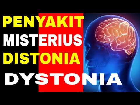 CARA MENGATASI PENYAKIT DISTONIA/DYSTONIA