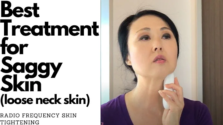 BEST TREATMENT FOR  LOOSE NECK SKIN? RADIO FREQUEN...