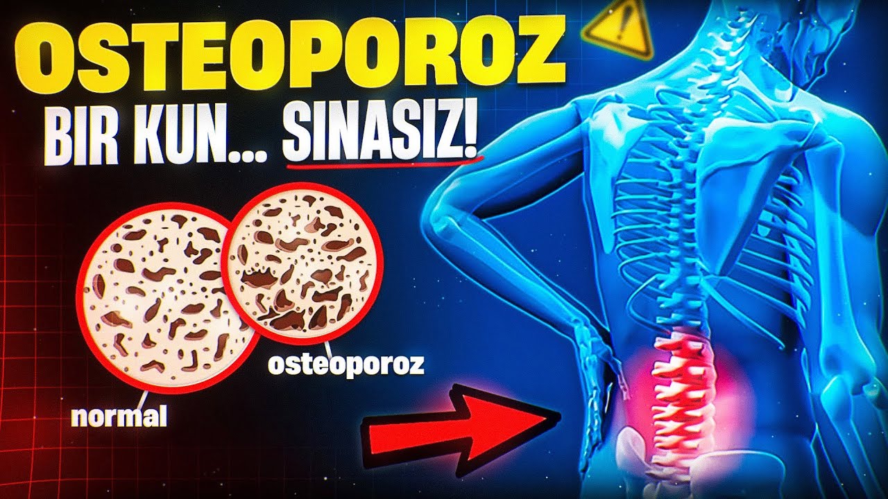 Остеопороз – Бир кун... синасиз! | Доктор Гулбаҳор