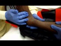 Ankle Dislocation Reduction
