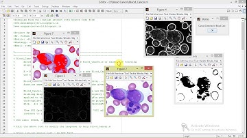 Blood Cancer Detection Using Matlab Project with Source Code Final Year Project | Leukemia Detection