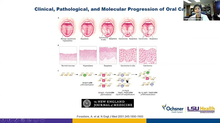 2021 Siciliano Lecture |  Cherie-Ann Nathan, MD, F...