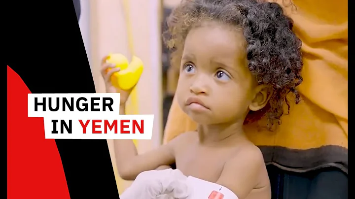 Hunger in Yemen: A Message from Asma Al-Atfi