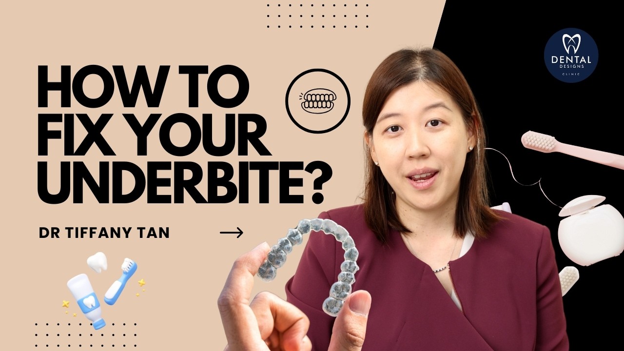 Do You Have an Underbite? What You Need to Know About Invisalign - YouTube