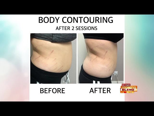 Body Contouring That Works 