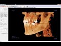 Invivo™ 5.4.5 Training Series: Introduction to the ArchSection View Tab