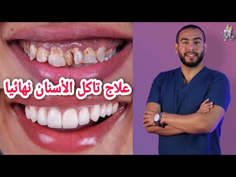 فيديو: 3 طرق لحماية أسنانك من التآكل الحمضي