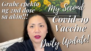 My Second Dose Covid Vaccine Update - BeyPelvlogs