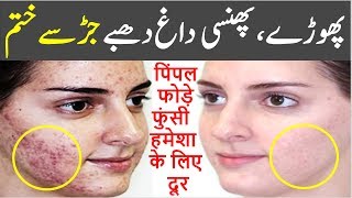 How to Remove Pimples and Dark Spots from Face Naturally at Home in Urdu | Chehre Ke Daag Dhabe Door