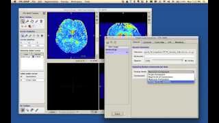 ITK-SNAP multicomponent demo