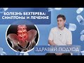 Болезнь Бехтерева: симптомы и лечение | Здравый подход (2025)