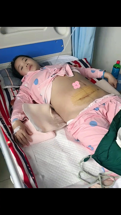 Cesarean section Delivery C-section Delivery cesarean birth Although I feel a little regretful