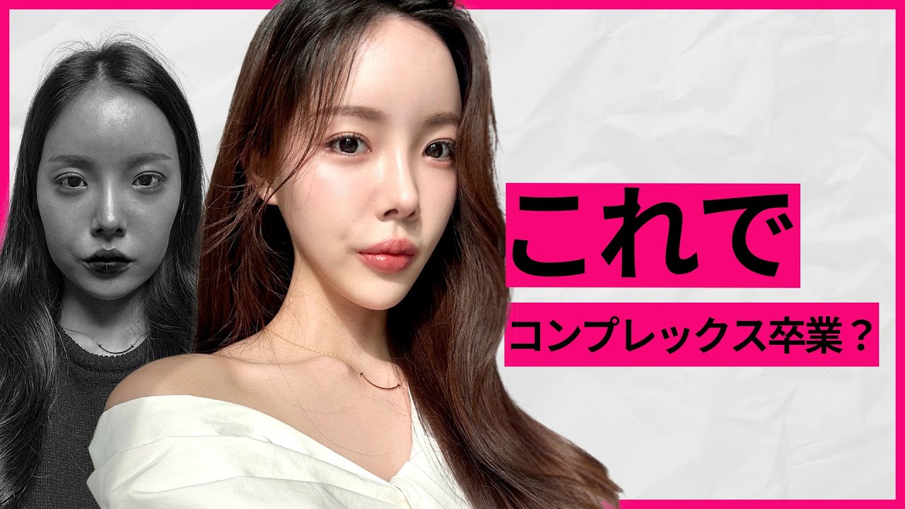 [整形症例] 何年も悩んだコンプレックス、この整形でついに自分を好きになれた！