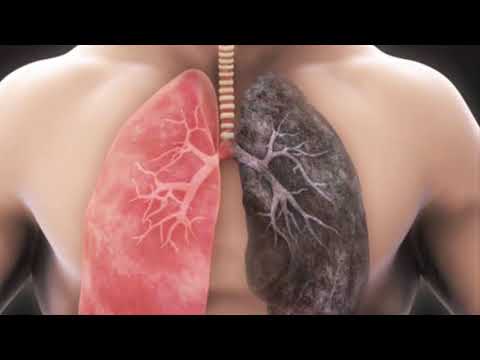 Video: Si të rivendosni shëndetin e mushkërive