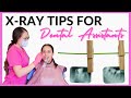 HOW TO TAKE DENTAL XRAYS | Tips for Dental Assistants