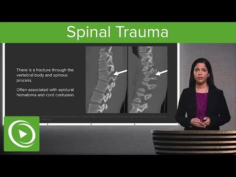 Spinal Trauma: Cervical Trauma Protocol, Common Spinal Fractures – Radiology | Lecturio