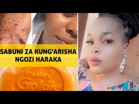 Video: Njia 3 za Kuondoa Madoa ya manjano kutoka kwa Ngozi