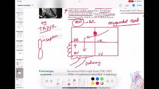 Atrial septal defect #cardiology 61 | First Aid USMLE Step 1 in Urdu/Hindi |