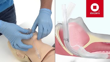Larynxmasker inbrengen | Doczero E-learning