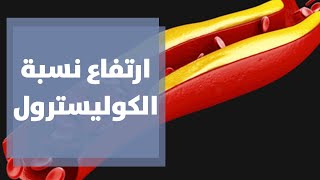 ارتفاع نسبة الكوليسترول والدهون الثلاثية - دنيا يا دنيا