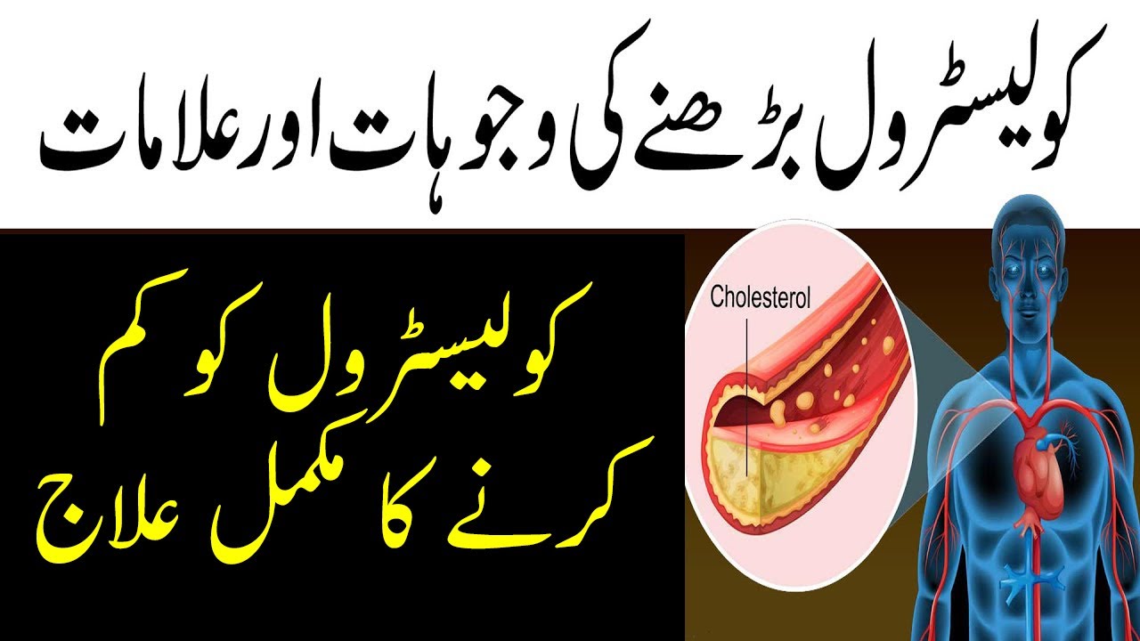 How To Reduce Cholesterol Level Cholesterol kam karne ka Tarika YouTube