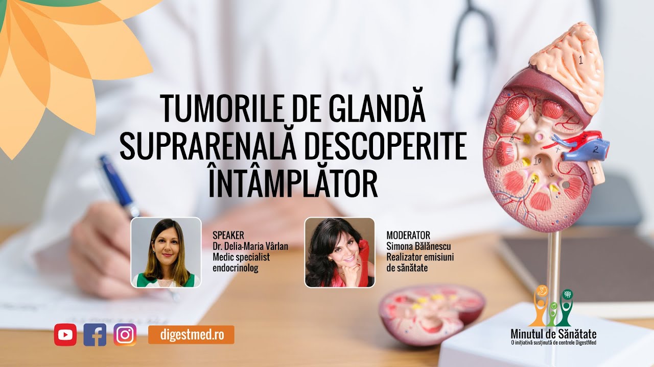 Minutul de Sănătate - Tumorile de glandă suprarenală descoperite întâmplător