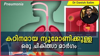 499: 💥 കടുത്ത ന്യൂമോണിയയുടെ (ARDS) ഒരു ചികിത്സാ മാർഗ്ഗം:  Prone Ventilation