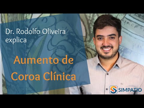 Vídeo: Quem faz alongamento de coroa?