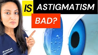 Is Astigmatism BAD? Astigmatism of the eye explained by Ophthalmologist