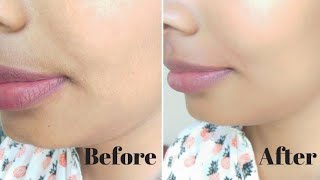 Remove Facial Hairs Permanently At Home | How To Remove Facial Hairs Instantly ( works 100% )