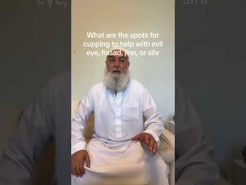 Spots For Cupping To Help Cancel Evil Eye Hasad Sihr And Jinn 