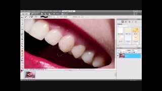 How to Apply: Vampire Fangs screenshot 5