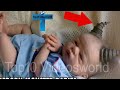 Top 11 Most Unusual Kids In The World  Kids With Unique Features