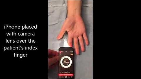 DD_Instant Heart Rate (modified Allen Test)