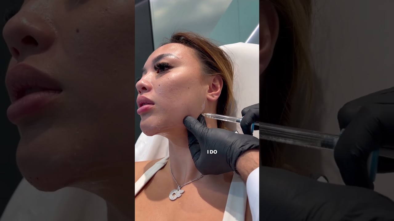 Jawline and chin reshaping with double board certified facial plastic surgeon Dr. Sanan